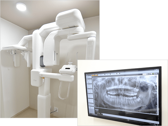 デジタルレントゲン歯科用CT