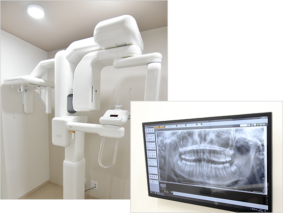 デジタルレントゲン歯科用CT